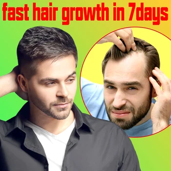 Эфирные масла для восстановления волос, лечение облысения, защита от выпадения, сыворотка для быстрого роста волос для мужчин и женщин